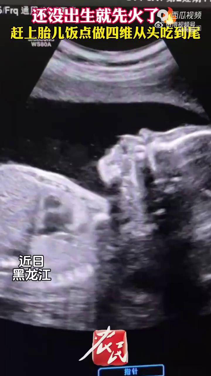 孕妇做四维检查拍下宝宝干饭瞬间，生命的奇妙之旅