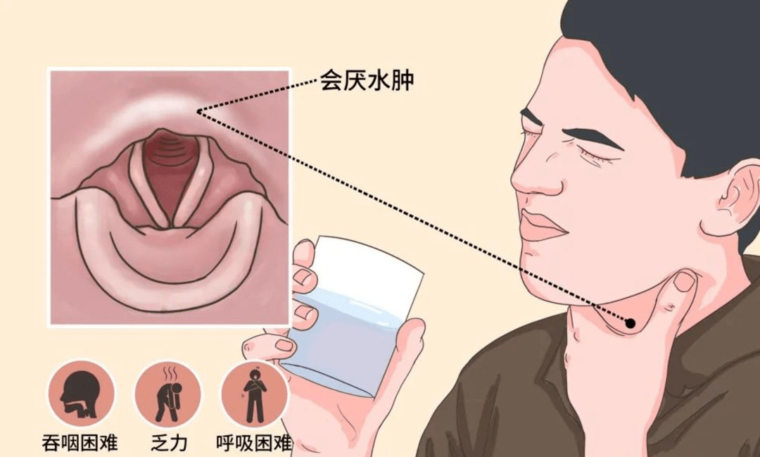 悲剧警醒，26岁女孩突发会厌炎致命，我们需要关注什么？