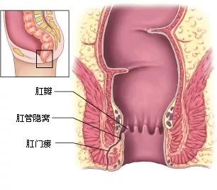男子花巨款屁股整形后遭遇肛门功能受损事件