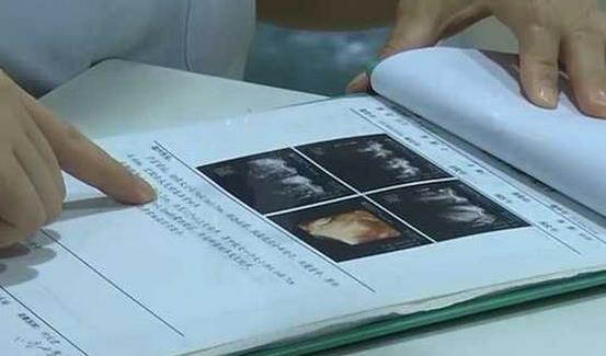 25岁女孩婚前体检意外发现无子宫，探寻身体与心理的双重挑战