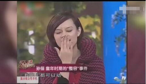 孙俪唇下痣，车祸玻璃碴致假性痣的背后故事
