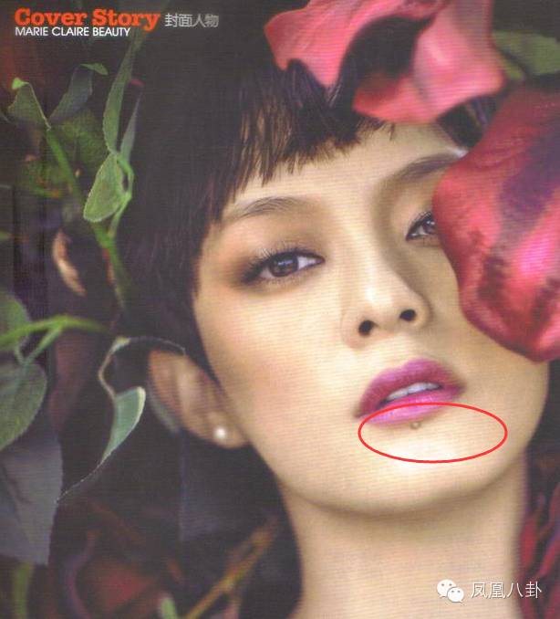 孙俪的唇下痣会有癌变风险吗？解读与解析