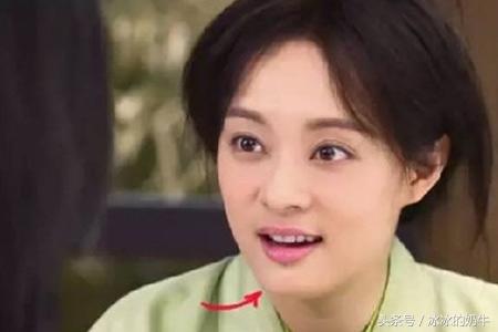 孙俪唇下痣没了，重塑美丽传说