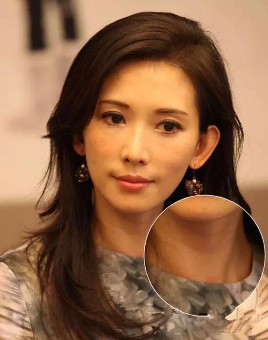 林志玲回应缩脖子事件，公众人物的言行与形象塑造
