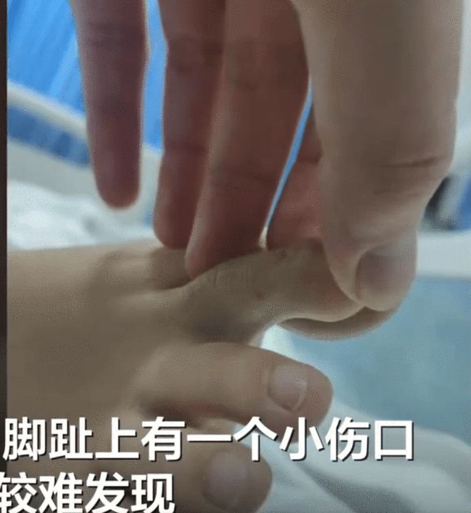 三亚被蛇咬伤致死女子伤口画面曝光，事件深度解析