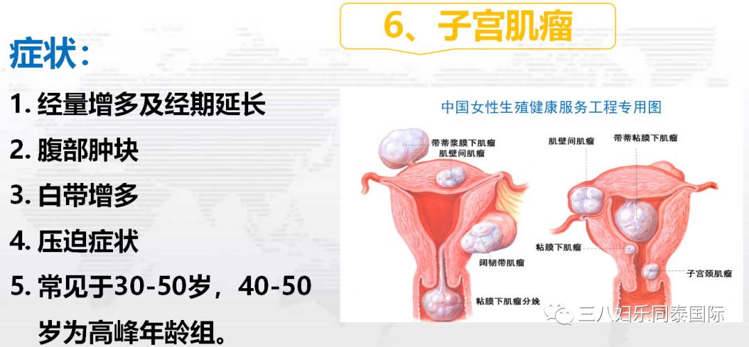 中国女性切除子宫的人数及其背后的社会关注