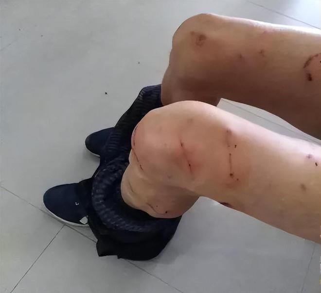 多名村民被恶犬咬伤事件，反思与行动
