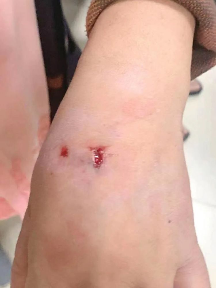 多名村民被恶犬咬伤事件，反思与行动