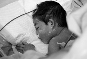 两岁幼童遭遇烧伤事件，婆婆对儿媳下跪，自责与愧疚交织