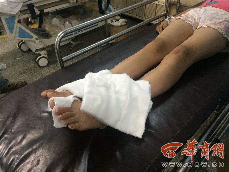 女子转身与男子相撞摔骨折获赔7万元，一起意外事件引发的深思
